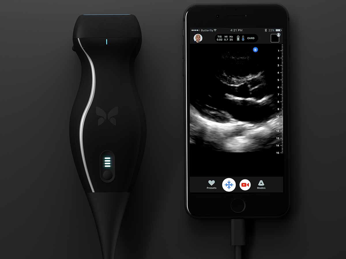 Jonathan Rothberg, father of a girl with tuberous sclerosis, got tired of being made to wait too long in hospitals and created the Butterfly IQ tool that allows ultrasound scans with the smartphone