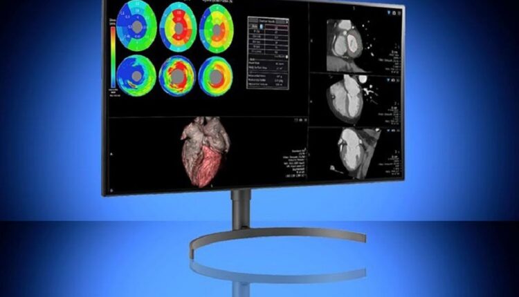 The company LG presented in Spain together with Vuno launched the first software to perform more agile X-ray diagnoses with artificial intelligence