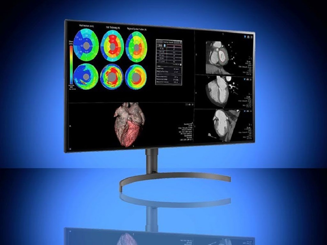 La empresa LG presentó en España conjuntamente con Vuno lanzó el primer software para realizar diagnósticos de rayos X más ágiles con inteligencia artificial