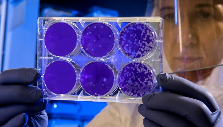 Mediante el uso de la inteligencia artificial los investigadores de la Universidad Tecnológica de Queensland en Australia han logrado identificar casi un millón de péptidos antimicrobianos que podrían ayudar en la resistencia bacteriana