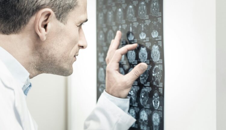 Según un estudio del Centro de Investigación en Nanomateriales y Nanotecnología (CINN) de Asturias (norte de España), mediante estímulos apropiados se puede lograr el rejuvenecimiento molecular del cerebro