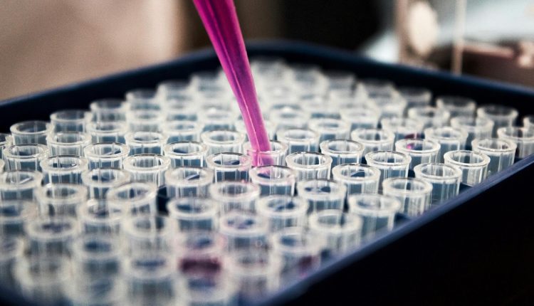 En Cuba se lleva a cabo la segunda fase de ensayos clínicos del medicamento Jusvinza, un producto de desarrollo local que alivia los síntomas dolorosos, así como la inflamación, en los pacientes que se recuperan del virus chikungunya